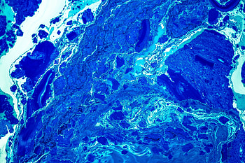 Abstract, Divorces, Liquid, Stains, Spots HD wallpaper