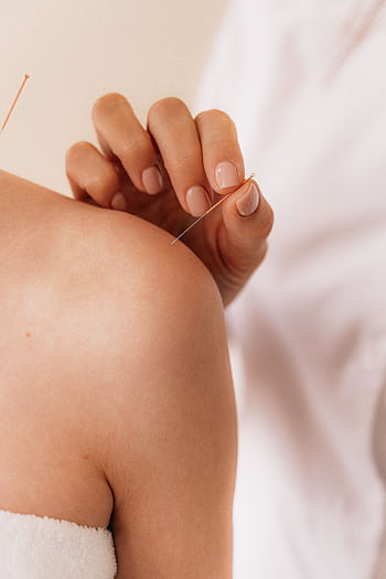 Close-up of acupuncture needle therapy on a patient's shoulder illustrating alternative medicine. HD phone wallpaper