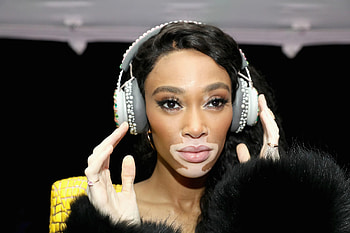 Winnie Harlow, Beauty line, May or may not, Starting HD wallpaper