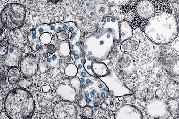 Abstract, Circles, Divorces, Stains, Spots, Bw, Chb HD wallpaper