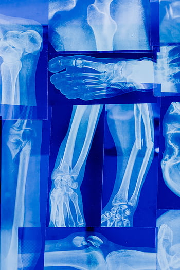 Detailed collage of human bone x-rays illustrating various skeletal parts in blue tonality. HD phone wallpaper