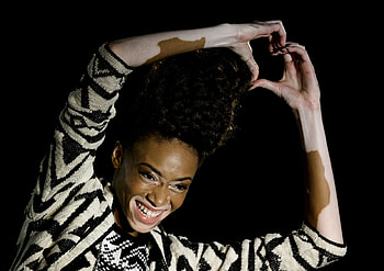 Winnie Harlow, Changing the face, CNN Style HD wallpaper