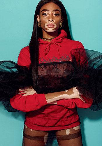 Winnie Harlow, Sultry poses, Mesmerizing beauty, Desired allure HD phone wallpaper