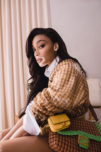 Winnie Harlow, Baguette friends, Unexpected campaign, Fashion icon HD phone wallpaper