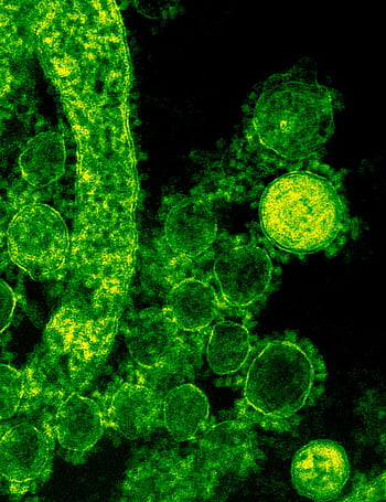 Green-tinted microscopic of coronavirus particles illustrating viral structures. HD phone wallpaper