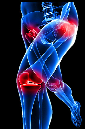 medical, pain,anatomy, pain, anatomy, health, orthopedics, Medical, Xray HD phone wallpaper