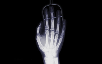 Dark, Hand, Dice, X-Ray, Roentgen, Bones, Computer Mouse HD wallpaper