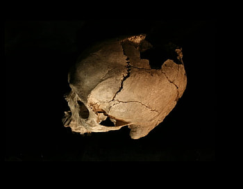 Blunt Force Trauma, abstract, graphy, broken, skull, damaged, people HD wallpaper