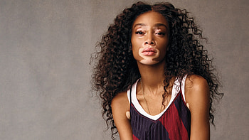 Winnie Harlow, Beautiful, Age of cookie HD wallpaper