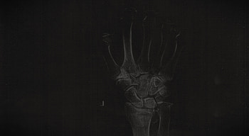 Xray, skeleton, X-ray, dark, bones HD wallpaper