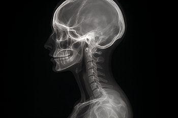 X-Ray Skull Profile, X-ray, skull, anatomy HD wallpaper