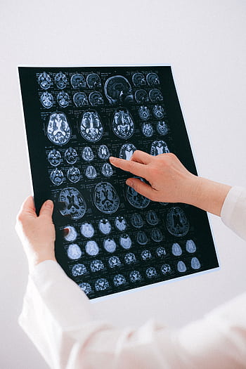 A medical professional examines a brain MRI scan, focusing on neurological health. HD phone wallpaper