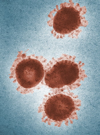 Colorized electron microscope showing coronavirus particles with distinct spike proteins. HD phone wallpaper