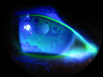 Dry Blue Eye, blue, ring, ball, center, eye HD wallpaper