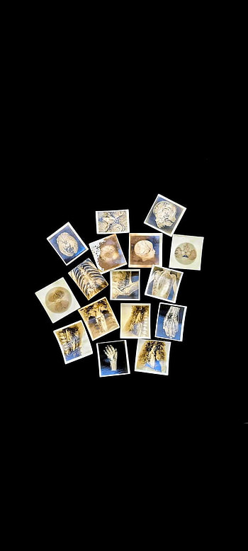 Medical x-rays, doctor_, doctors0, neet, medical_, medicine_ HD phone wallpaper