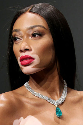 Winnie Harlow, Cannes 2017, Schnster Schmuck, Der Stars HD phone wallpaper