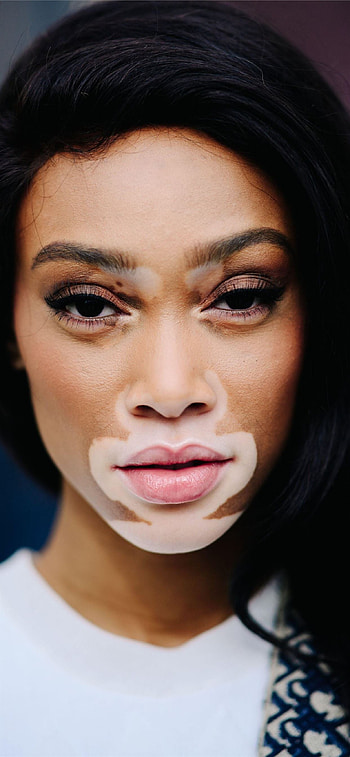 Winnie Harlow HD phone wallpaper