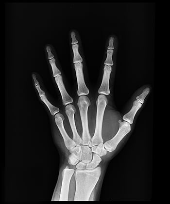 High-resolution X-ray capturing the bones of a human hand, displaying skeletal anatomy. HD phone wallpaper