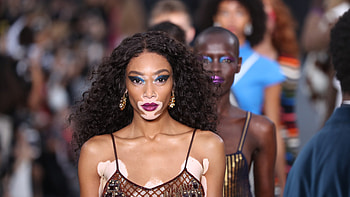 America's Next Top Model, Winnie Harlow, ANTM, Winnie pooh HD wallpaper