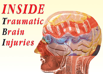 Traumatic Brain Injury, other, people, woman, man HD wallpaper