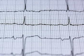 Close-up view of an ECG reading on graph paper, displaying heart rhythm and pulse data for medical analysis. HD wallpaper