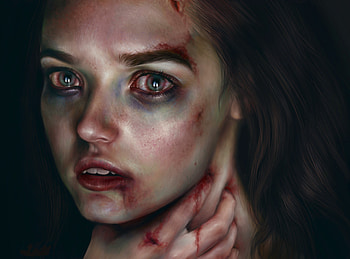Injured Girl Artistic, artist HD wallpaper