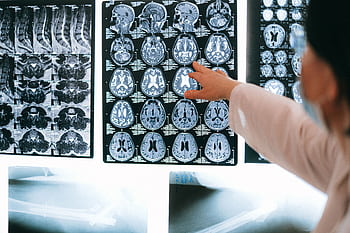 Radiologist pointing at brain MRI scans showing detailed medical examination. HD wallpaper