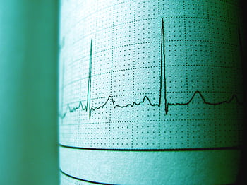 Close-up of an ECG printout displaying heartbeat rhythm and frequency for medical analysis. HD wallpaper