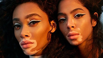 America's Next Top Model, Winnie Harlow, Saudi model, Al Bawaba HD wallpaper