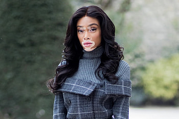 Winnie Harlow, Model sensation, Vitiligo advocate, Inspirational beauty HD wallpaper