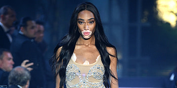 Winnie Harlow, Newest Victoria's Secret model, VS Fashion show, Fall HD wallpaper