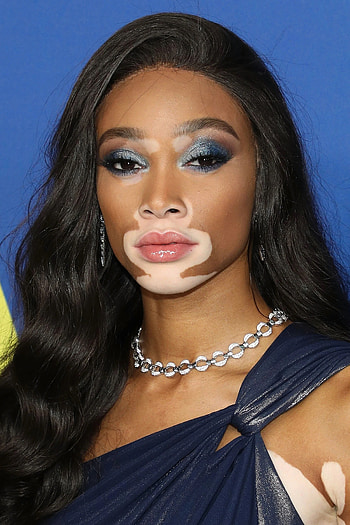 Winnie Harlow, Filme, Alter, Biographie HD phone wallpaper
