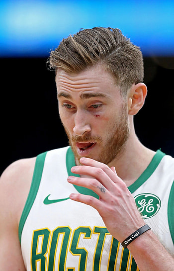 Gordon Hayward, Celtics notebook, Banged up, Boston Herald HD phone wallpaper