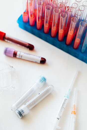 Assortment of test tubes and syringes on a white background, ideal for healthcare themes. HD phone wallpaper