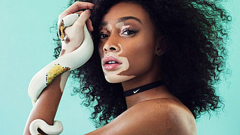 Winnie Harlow, What others say, Success story, Seneca HD wallpaper