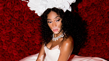 Winnie Harlow, What others say, Success story, Seneca HD wallpaper