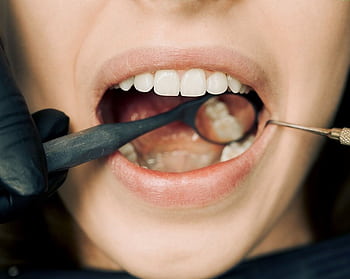 Close-up of a dental examination with modern equipment, showcasing oral hygiene maintenance. HD wallpaper