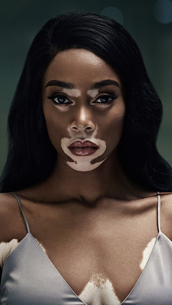 Winnie Harlow, Volkswagen T Roc, Born confident, Features HD phone wallpaper