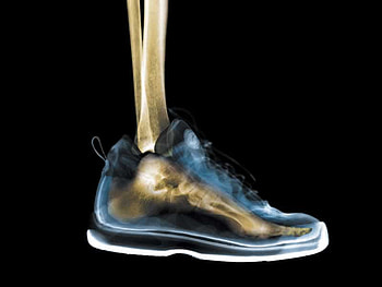 Shoe for a Skeleton, x-ray, shoe, seleton, foot HD wallpaper