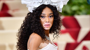 America's Next Top Model, Winnie Harlow, ANTM, Stylecaster HD wallpaper