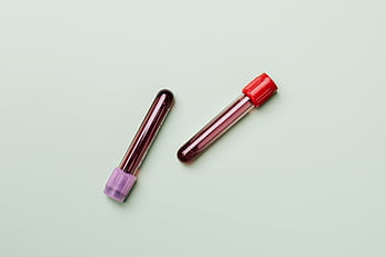 Blood samples in test tubes on a light background, ideal for medical and laboratory themes. HD wallpaper